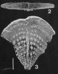 Inflatobolivinella subrugosa (Butt) GAMONT