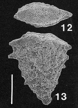 Nodobolivinella jhingrani (Kalia)