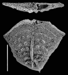 Nodobolivinella victoria Hayward PARATYPE