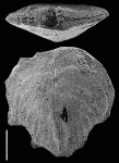 Punctobolivinella philippinensis (McCulloch) SCHIZONT