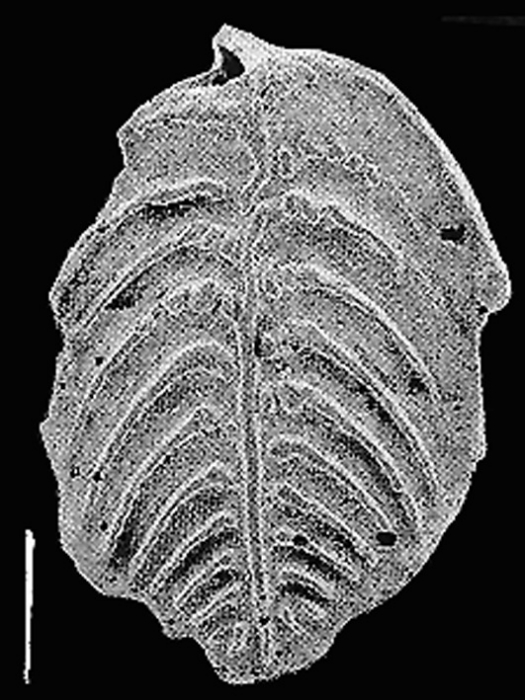 Rugobolivinella pendens (Collins) Rugobolivinella pendens (Collins)
