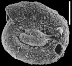 Glomospira cf. fijiensis New Zealand