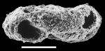 Glomospira cf. fijiensis New Zealand