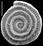 Spirillina denticulogranulata