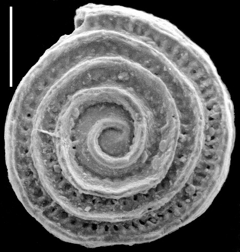 Spirillina denticulogranulata Spirillina denticulogranulata