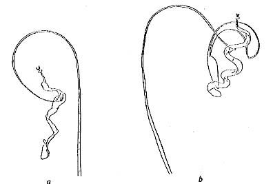 Paromalostomum fusculum