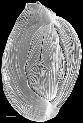 Quinqueloculina bicornis New Zealand Quinqueloculina bicornis New Zealand