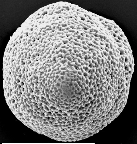 Glabratellina kermadecensis New Zealand paratype Glabratellina kermadecensis New Zealand paratype