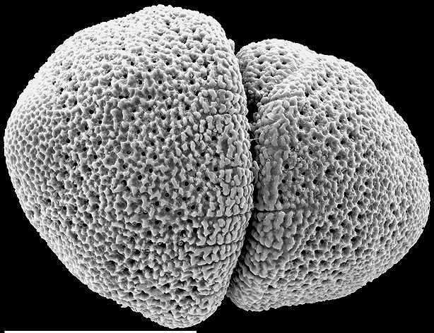 Glabratellina kermadecensis New Zealand paratype plastogammic pair Glabratellina kermadecensis New Zealand paratype plastogammic pair