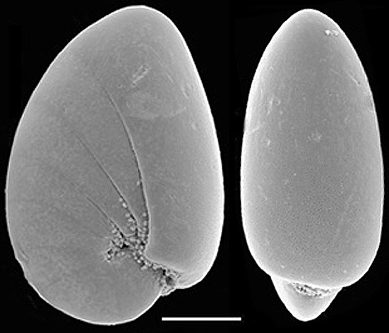 Nonionoides turgida New Zealand Nonionoides turgida New Zealand