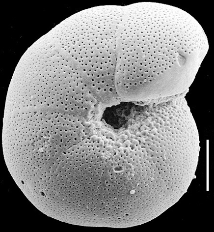 Anomalinoides sphericus New Zealand Anomalinoides sphericus New Zealand