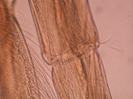 Part: Antennal peduncle