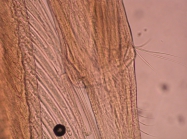 Part: Antennal peduncle