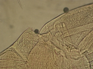 Part: Antennal scale