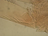 Part: Antennal scale