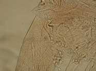 Part: Antennal scale