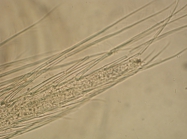 Part: Antennal scale