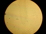 Part: Endo - uro