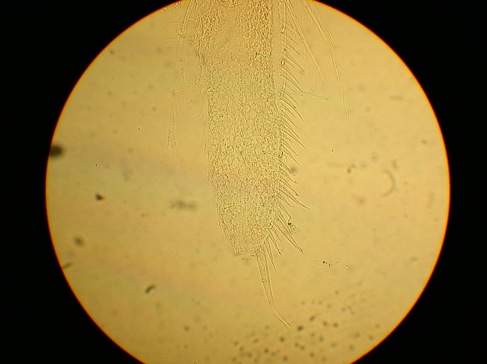 Part: Endo - uro Part: Endo - uro