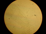 Part: Endo - uro