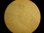 Part: Endo - uro