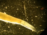 Part: Abdomen lateral
