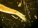 Part: Abdomen lateral