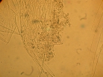 Part: Endo - uro