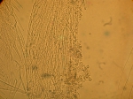 Part: Endo - uro