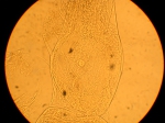 Part: Endo - uro
