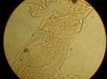 Part: Endo - uro