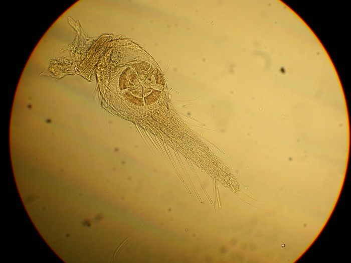 Part: Endo - uro Part: Endo - uro