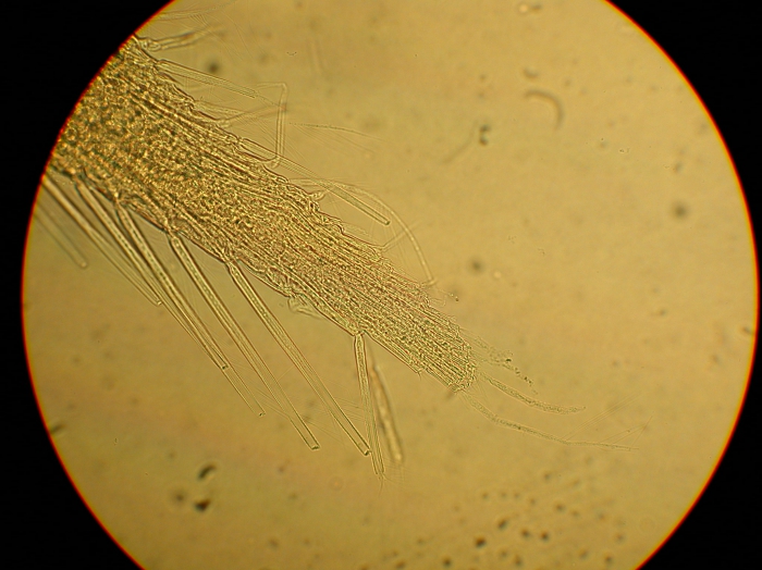 Part: Endo - uro Part: Endo - uro