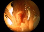 Part: Head ventral
