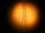 Part: Endo - uro