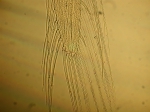 Part: Endo - uro