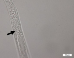 Nematoda (roundworms)