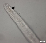 Diplopeltula bulbosa