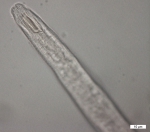 Diplopeltula bulbosa