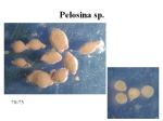 Protozoa