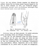Thoracostoma vallini