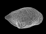 Ostracoda