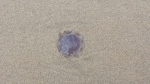 Scyphozoa (jelly fish)